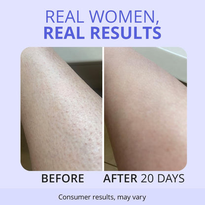 Exfoliating Body Scrub for Rough & Dry Skin
